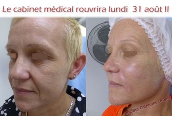 Fils tenseurs - Dr Catherine Dropsy