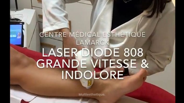 Épilation Laser Diode 808 nm très grande vitesse & indolore - Dr. Pascal Didi