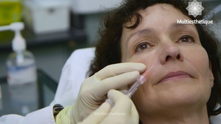 Rajeunissement visage