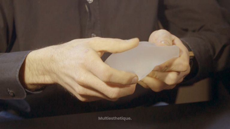 Augmentation mammaire par implant ou lipofilling